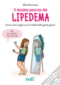 Ti racconto tutto sul mio lipedema. Come vivere meglio con la �malattia delle gambe grosse�
