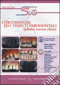 L'ortondonzia ed i tessuti parodontali. Syllabus teorico-clinico. Con CD-ROM libro