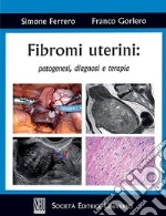 Fibromi uterini: patogenesi, diagnosi e terapia