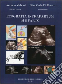 Ecografia intrapartum ed il parto