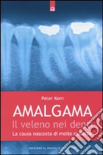 Amalgama. Il veleno nei denti. La causa nascosta di molte malattie libro