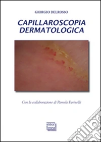 Capillaroscopia dermatologica