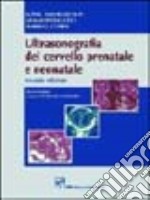 Ultrasonografia del cervello prenatale e neonatale