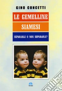 Le gemelline siamesi. Separarle o non separarle?