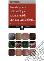 La ciclosporina nelle patologie autoimmuni di interesse dermatologico