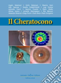 Il cheratocono