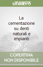 La cementazione su denti naturali e impianti libro