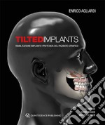 Tilted implants. Riabilitazione implanto-protesica del paziente atrofico