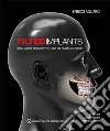 Tilted implants. Riabilitazione implanto-protesica del paziente atrofico libro