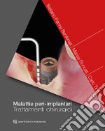 Malattie peri-implantari. Trattamenti chirurgici libro