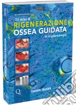 20 anni di rigenerazione ossea guidata in implantologia libro