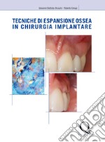 Tecniche di espansione ossea in chirurgia implantare