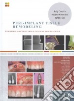 Peri-implant tissue remodeling. Scientific background and clinical implications