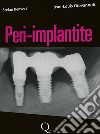 Peri-implantite libro