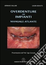 Overdenture su impianti. Manuale atlante libro