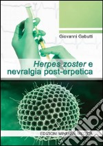 Herpes zoster e nevralgia post-erpetica