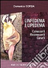 Linfedema e lipedema. Conoscerli. Riconoscerli. Curarli libro