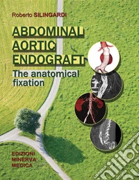Abdominal aortic endograft. The anatomical fixation