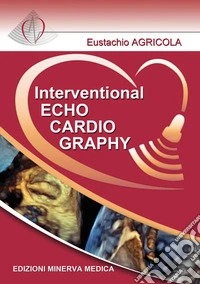 Interventional echocardiography
