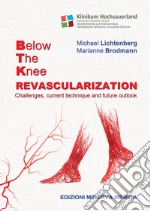 Below the knee revascularization. Challenges, current technique and future outlook libro