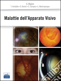 Malattie dell'apparato visivo
