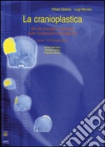 La cranioplastica