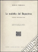 La malattia del Dupuytren