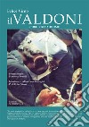 Il Valdoni. Chirurgia addome libro