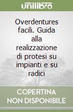 Overdentures facili. Guida alla realizzazione di protesi su impianti e su radici libro