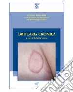 Orticaria cronica