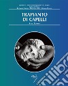 Trapianto di capelli libro