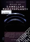 Atlas of lamellar keratoplasty. Con DVD libro