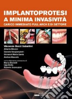 Implantoprotesi a minima invasività. Carico immediato full arch e di settore