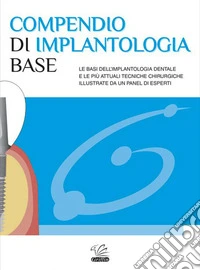 Compendio di implantologia base