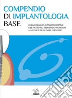 Compendio di implantologia base libro