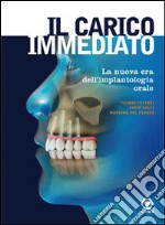 Il carico immediato. La nuova era dell'implantologia orale libro