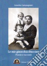 Le mie ginocchia sbucciate. Poesie e racconti