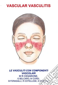 Vascular vasculitis. Vasculiti con componenti vascolari