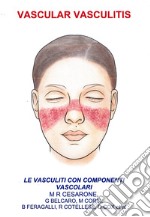 Vascular vasculitis. Vasculiti con componenti vascolari libro