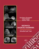 Risonanza magnetica mammaria. Istruzioni per l'uso libro