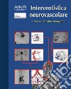 Interventistica neurovascolare libro