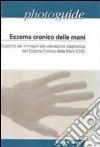 Eczema cronico delle mani. Supporto per immagini alla valutazione diagnostica dell'eczema cronico delle mani libro