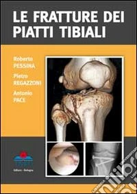 Le fratture dei piatti tibiali libro