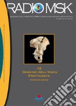 Imaging dell'anca fratturata libro