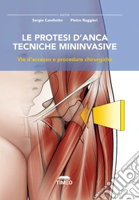 Le protesi d'anca. Tecniche mininvasive. Vie d'accesso e procedure chirurgiche. Ediz. illustrata libro
