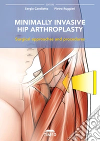 Minimally invasive hip arthroplasty. Surgical approaches and procedures libro