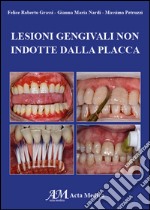 Lesioni gengivali non indotte dalla placca