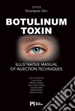 Botulinum toxin. Ilustrative manual of injection techniques. Ediz. a colori libro