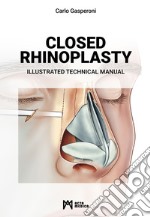 Closed rhinoplasty. Illustrated technical manual libro