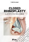 Closed rhinoplasty. Illustrated technical manual libro